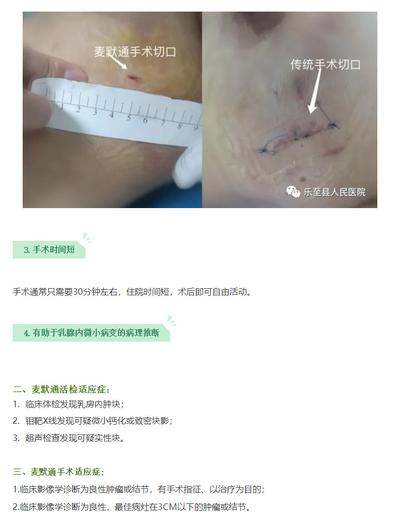 【医院动态】我院成功引进麦默通—先进乳腺微创旋切系统_03.jpg