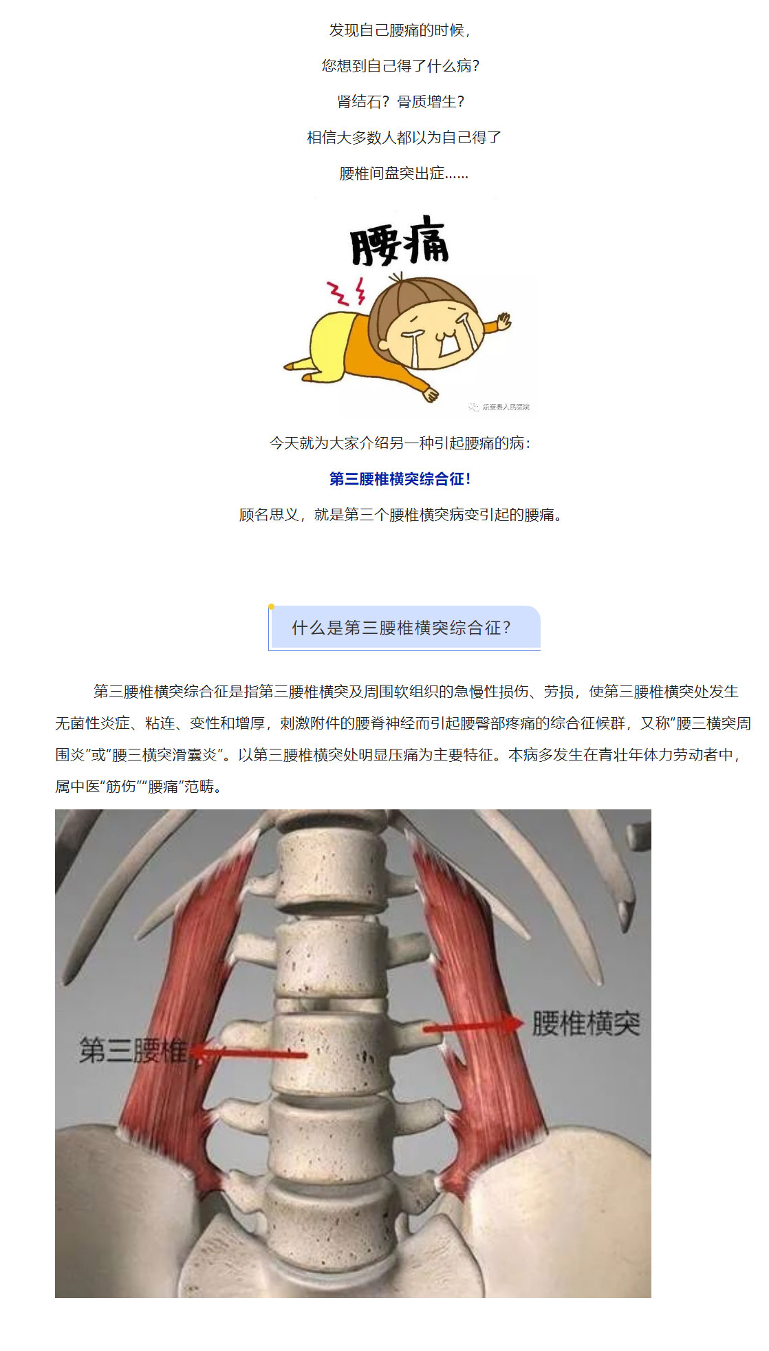 【科普】不是所有的腰痛都是腰椎间盘突出——第三腰椎横突综合征，了解一下_03.jpg